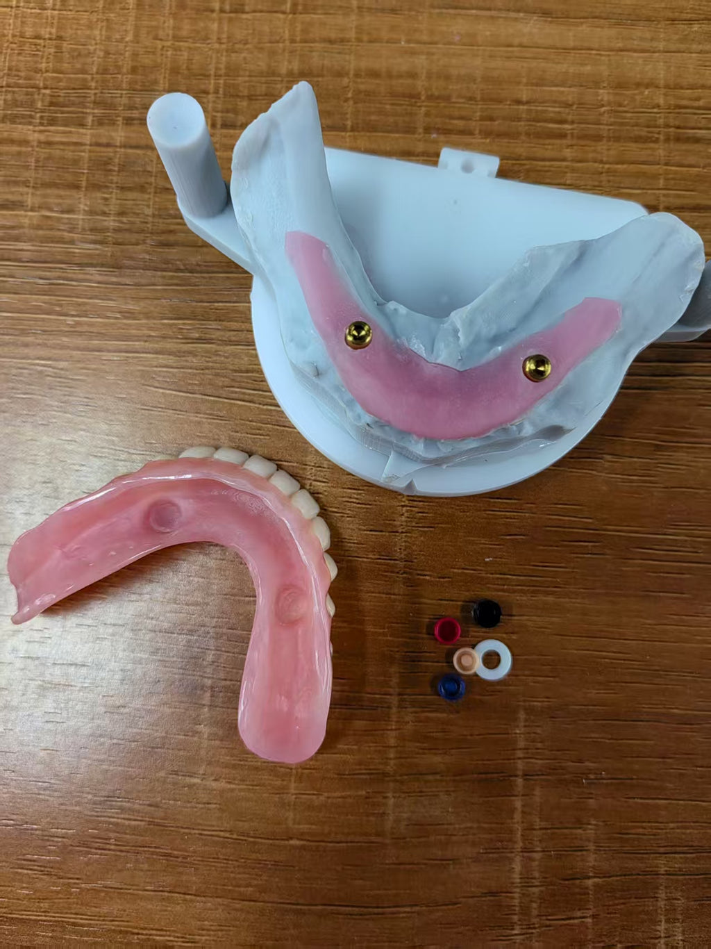 Locator Overdenture Implant Acrylic Denture Restoration