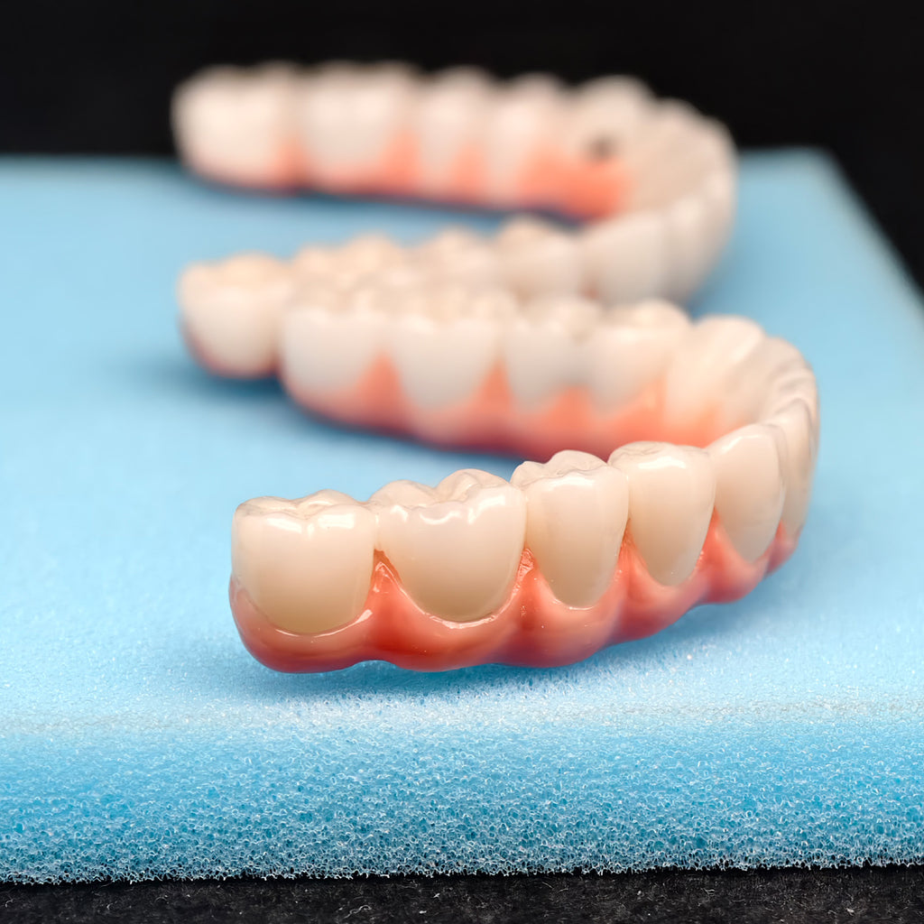 Malo Bridge Implant Restorations