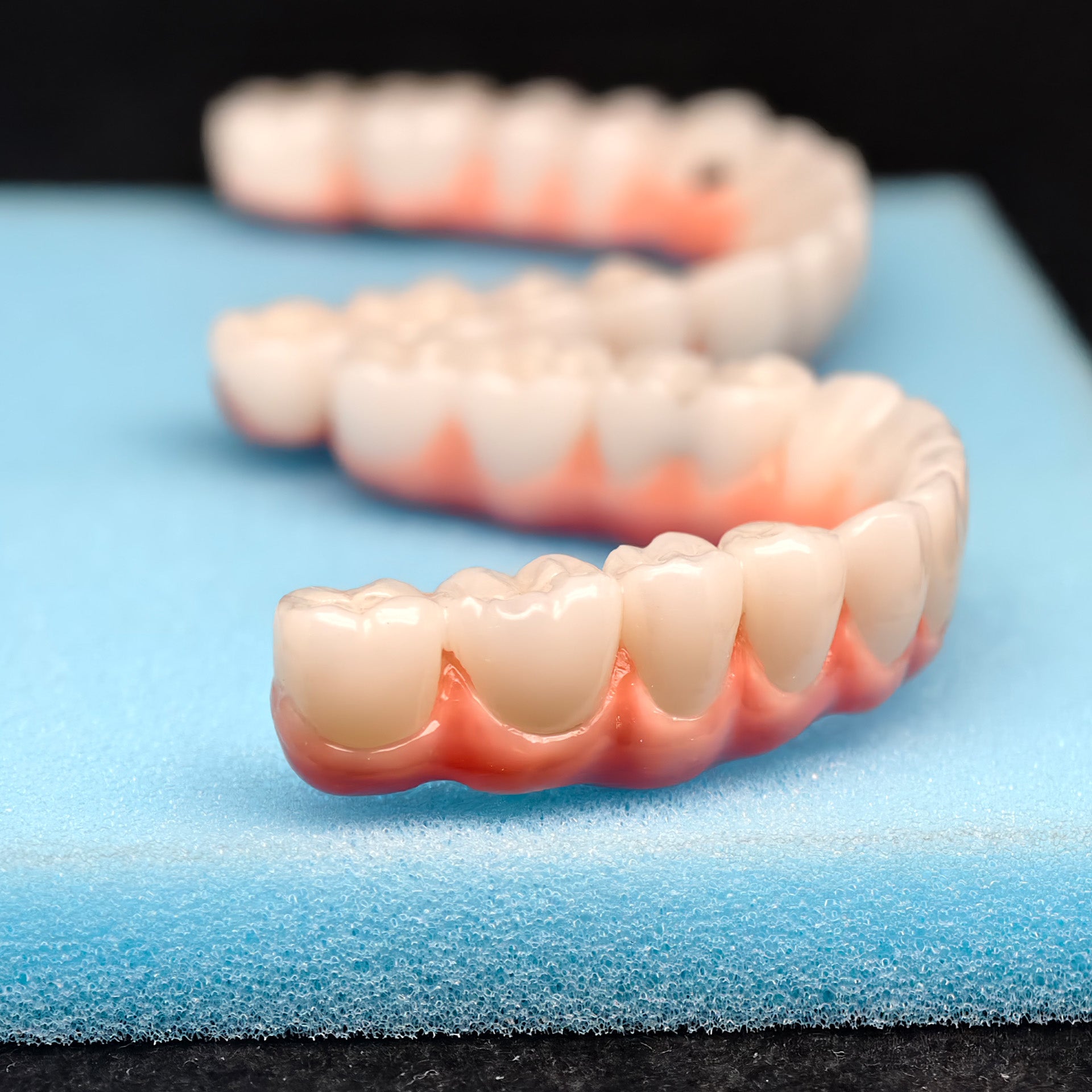 Malo Bridge Implant Restorations