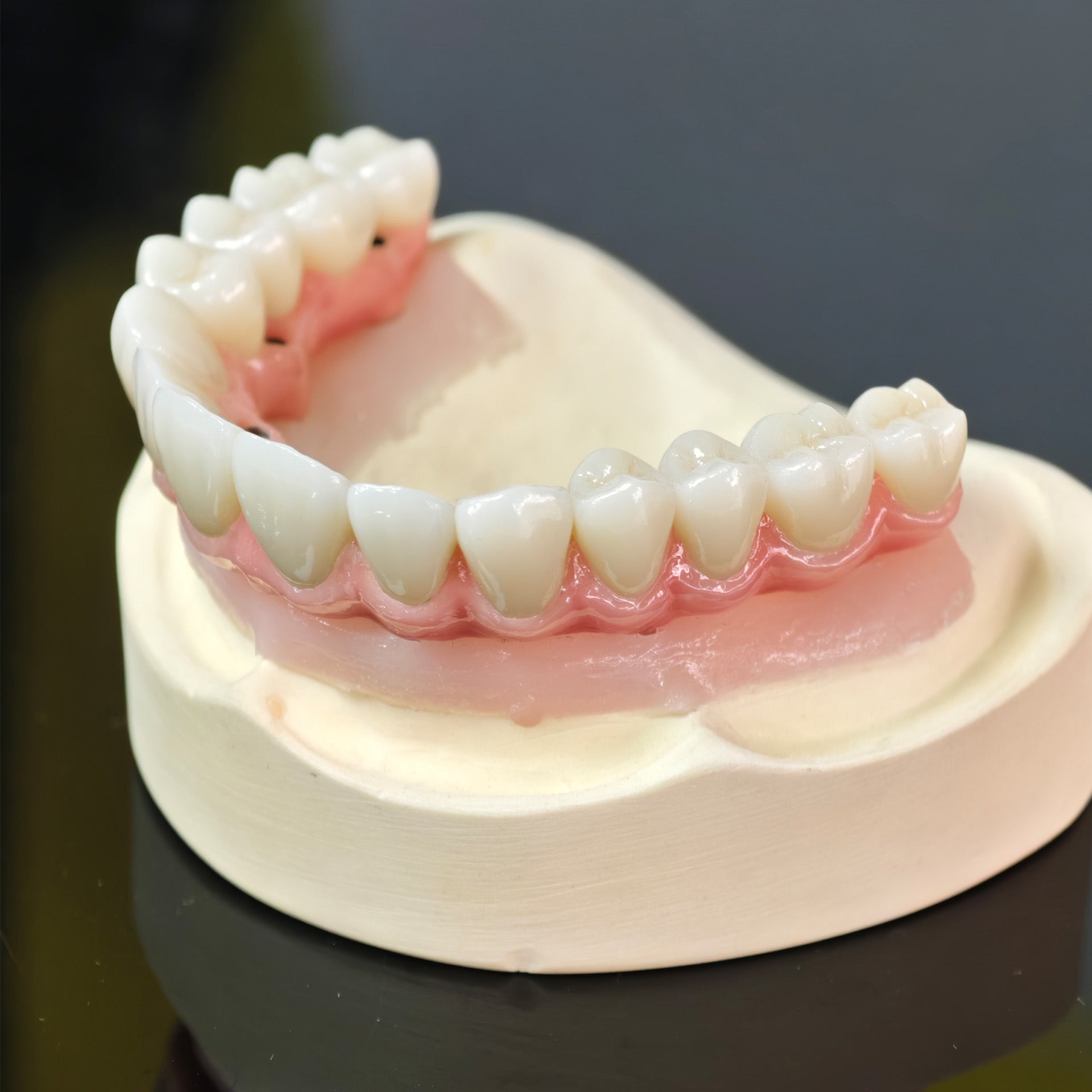 Malo Bridge With Gold-Plated Grade 5 Pure Titanium Malo Bridge