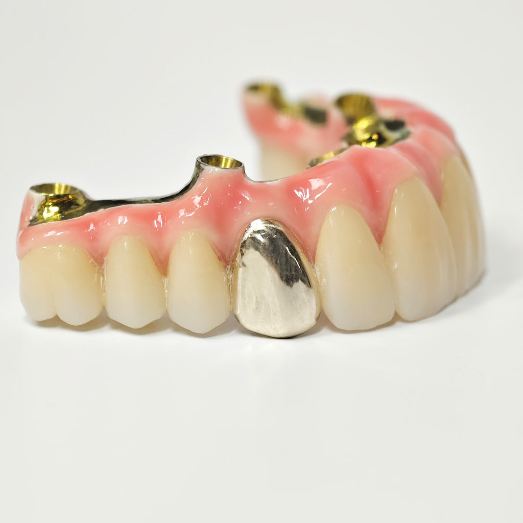 Malo Bridge With Gold-Plated Titanium Framework And A Gold Crown