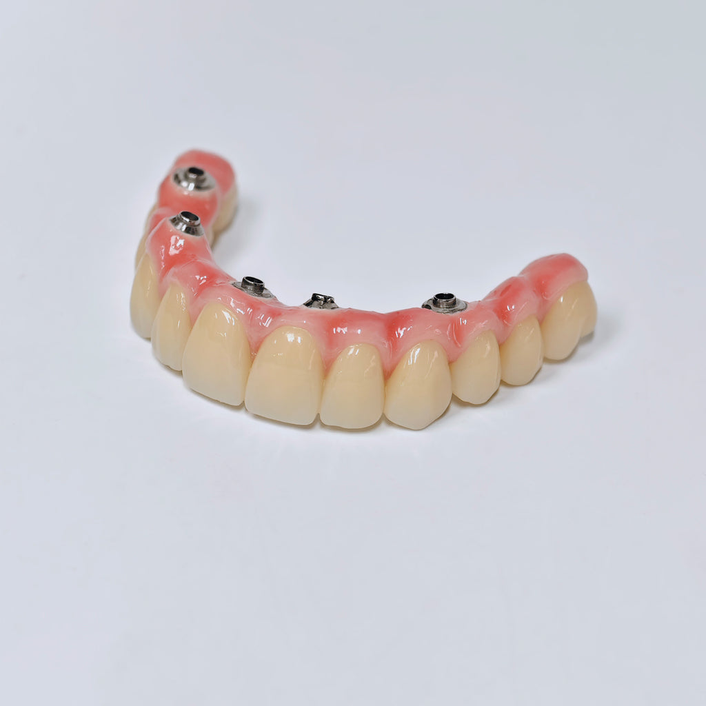 Malo Bridge With Screw-Retained