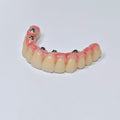 Malo Bridge With Screw-Retained