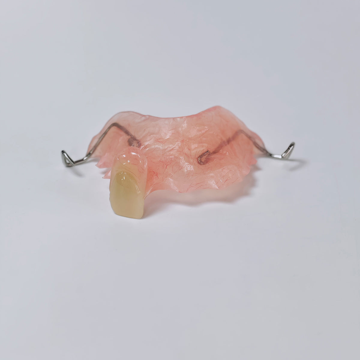 Metal Clasp Partial Denture