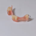 Metal Clasp Partial Denture