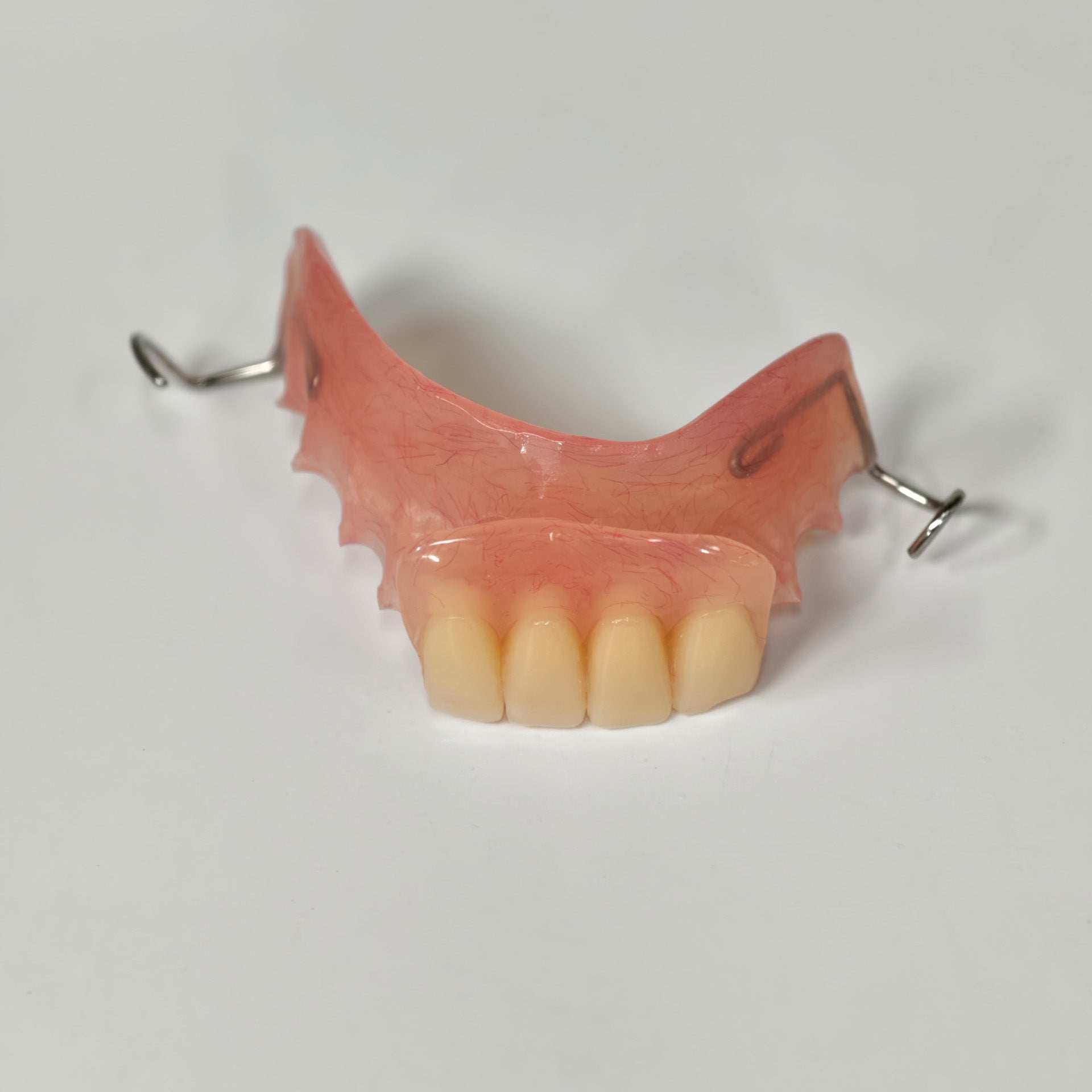 Metal Clasp Partial Denture
