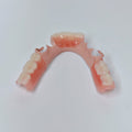 PEEK Framework Denture Metal Framework With Acrylic Denture