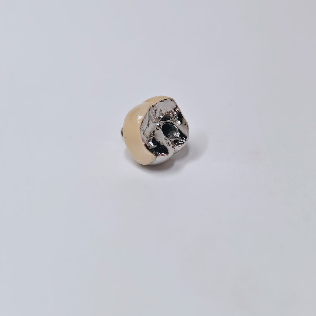 PFM Crown With Screw Retained