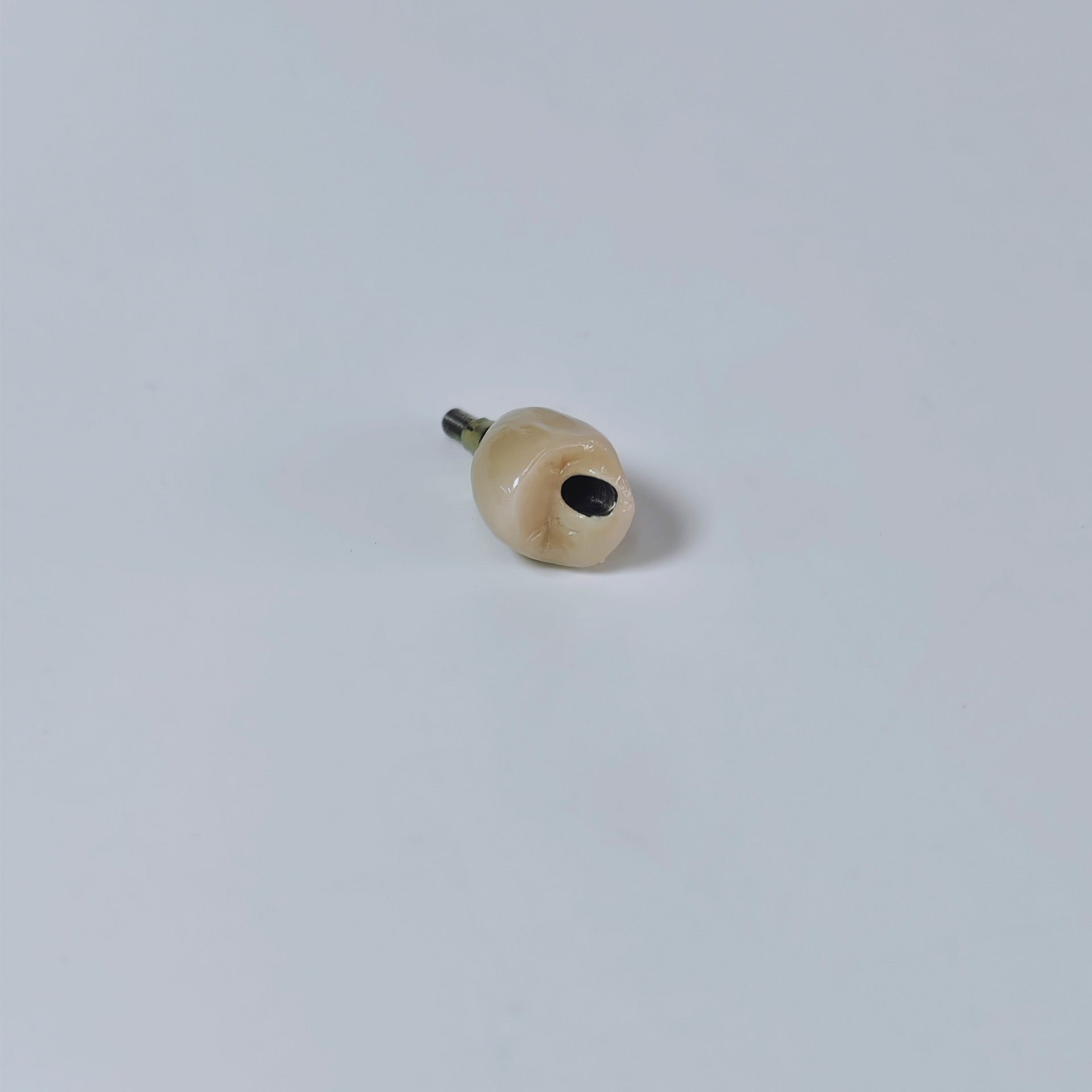PFM Crown With Screw Retained