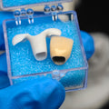 PFM Implant Crown With Cement Retained