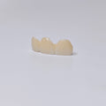 PFZ Dental Bridge – Depth And Aesthetics