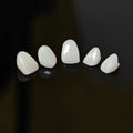 PFZ Porcelain Fused Zirconia Aidite Zirconia