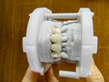 PFZ With Transparent In Incisal