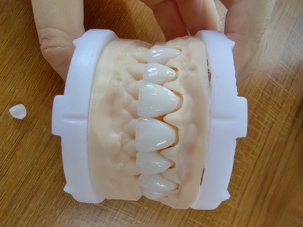 PFZ Zirconia Crowns And Bridge