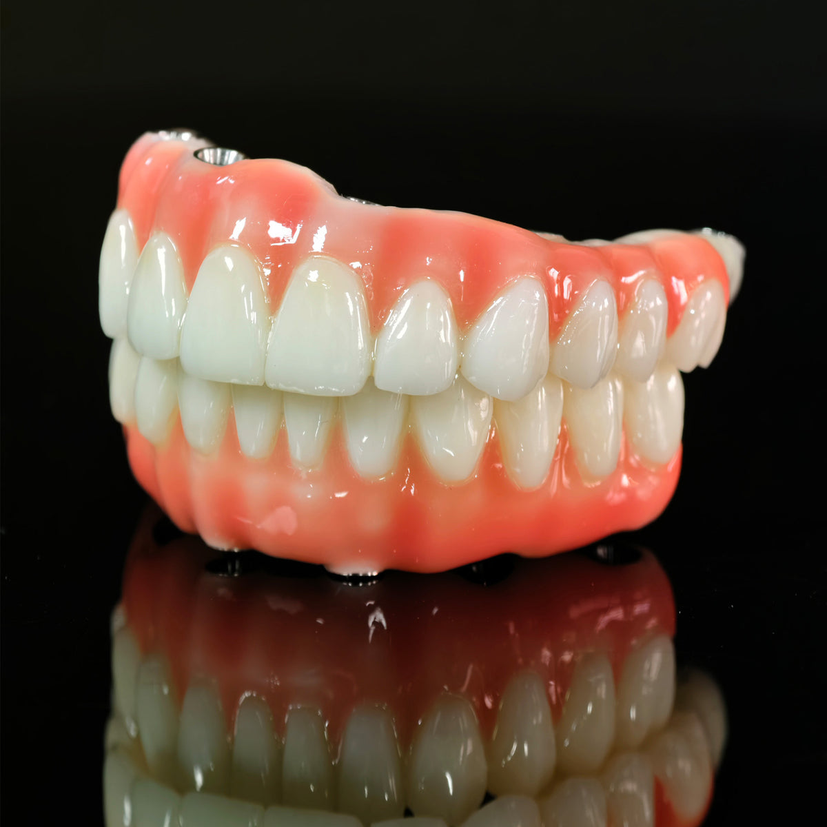 PMMA Bridge With Ti-Base Screw Retained Trying For Full Arch Restoration