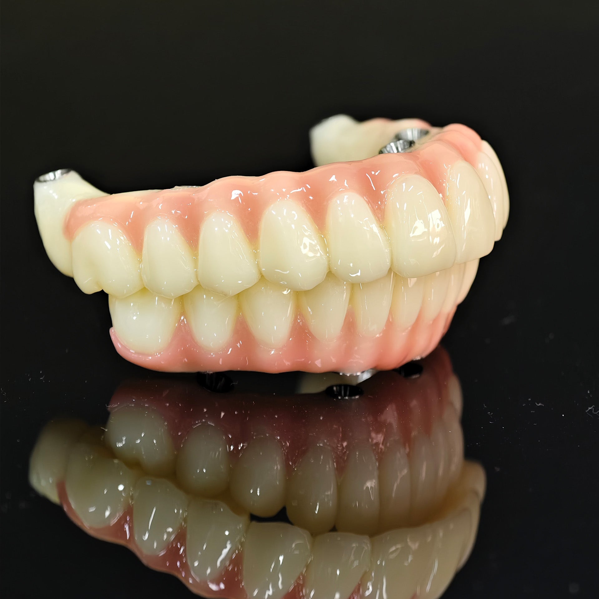 PMMA Bridge With Ti-Base Screw Retained Trying For Full Arch Restoration