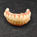 PMMA Bridge With Ti-Base Screw Retained Trying For Full Arch Restoration