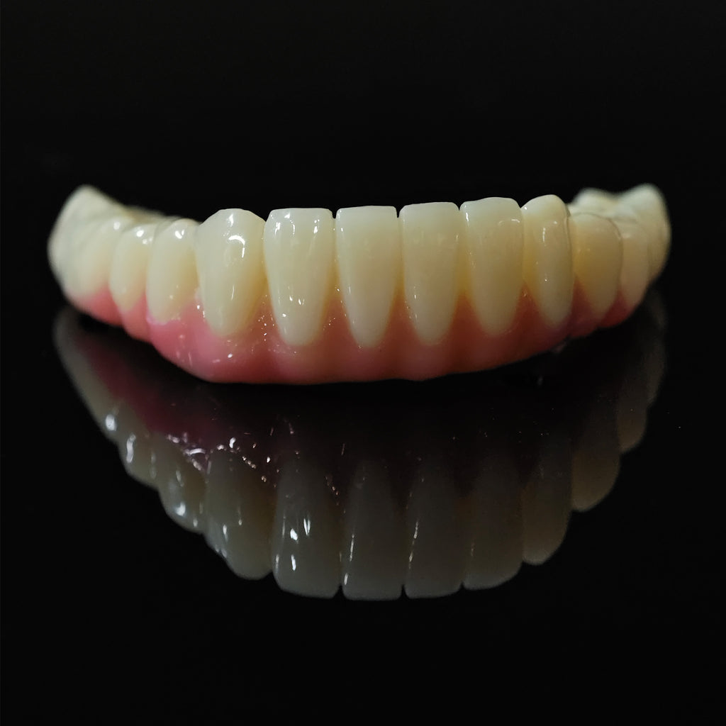 PMMA Bridge With Ti-Base Screw Retained Trying For Full Arch Restoration