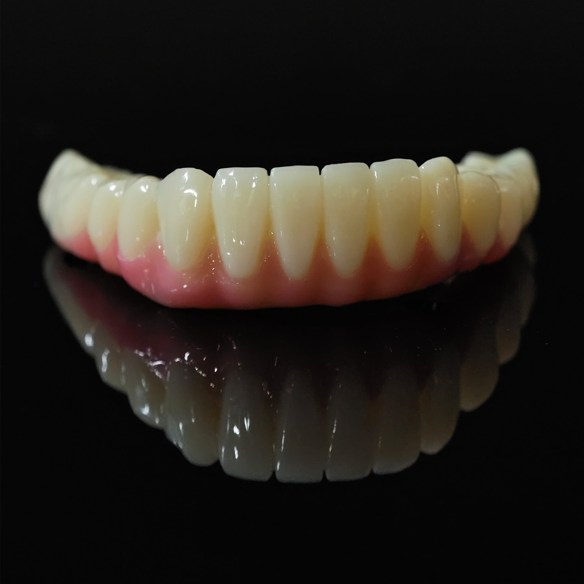 PMMA Bridge With Ti-Base Screw Retained Trying For Full Arch Restoration
