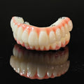 PMMA Bridge With Ti-Base Screw Retained Trying For Full Arch Restoration