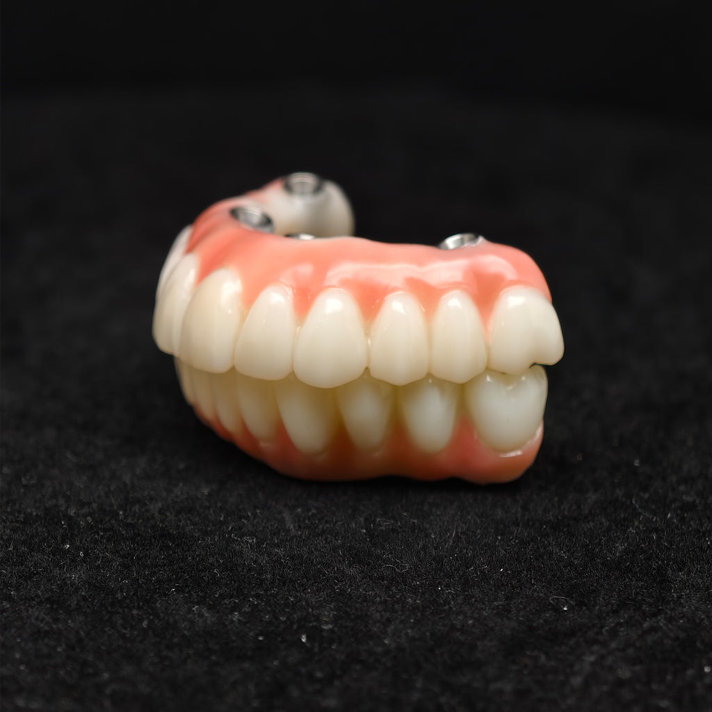 PMMA Bridge With Ti-Base Screw Retained Trying For Full Arch Restoration