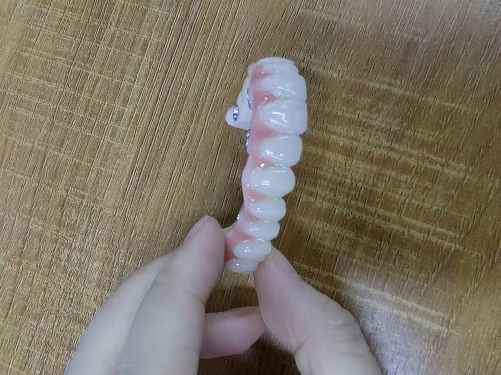 PMMA Bridge With Ti-Base Screw Retained Trying For Full Arch Restoration