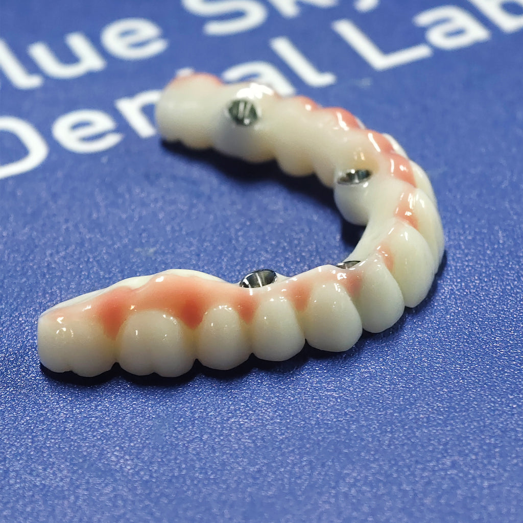 PMMA Bridge With Ti-Base Screw Retained Trying For Full Arch Restoration