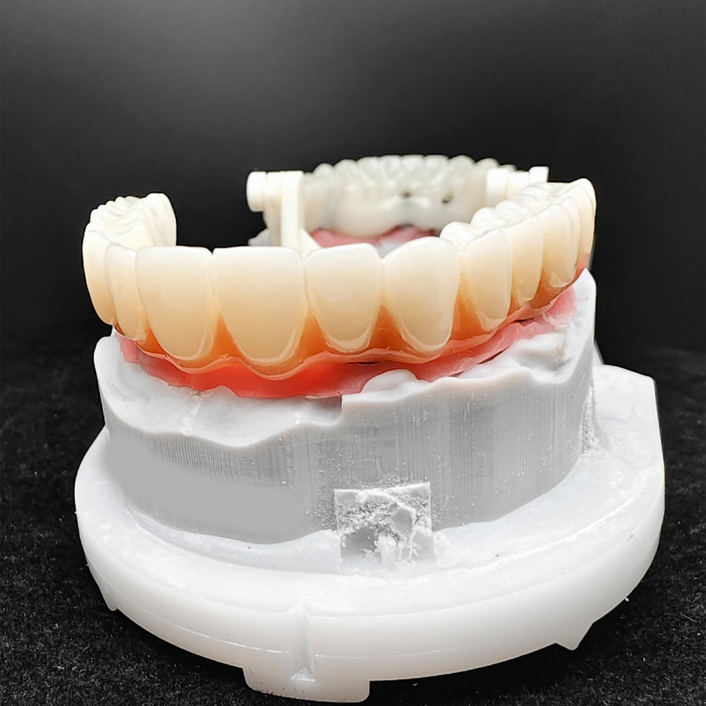 PMMA Bridge With Ti-Base Screw Retained Trying For Full Arch Restoration