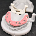 PMMA Bridge With Ti-Base Screw Retained Trying For Full Arch Restoration