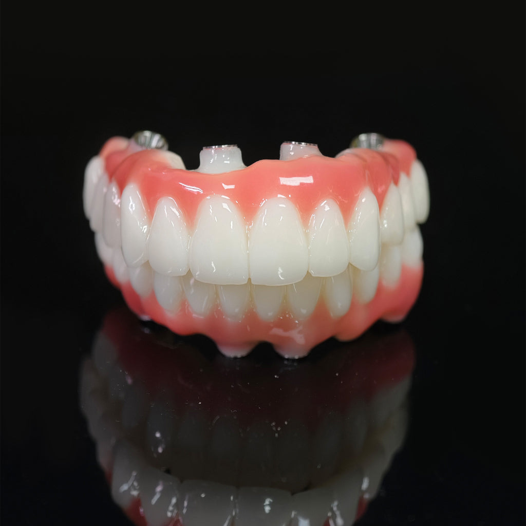 PMMA Bridge With Ti-Base Screw Retained Trying For Full Arch Restoration