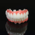 PMMA Bridge With Ti-Base Screw Retained Trying For Full Arch Restoration