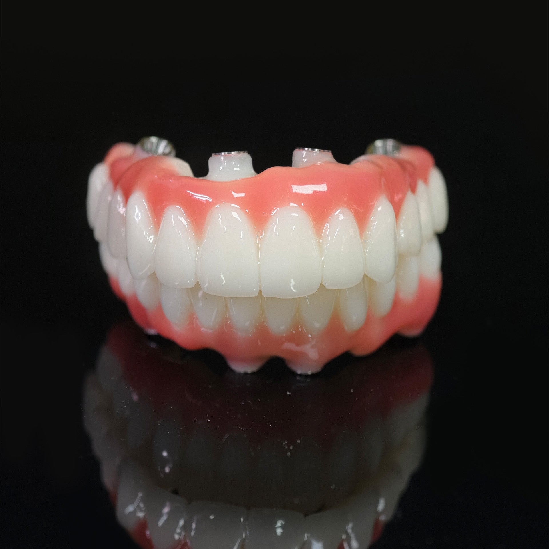 PMMA Bridge With Ti-Base Screw Retained Trying For Full Arch Restoration