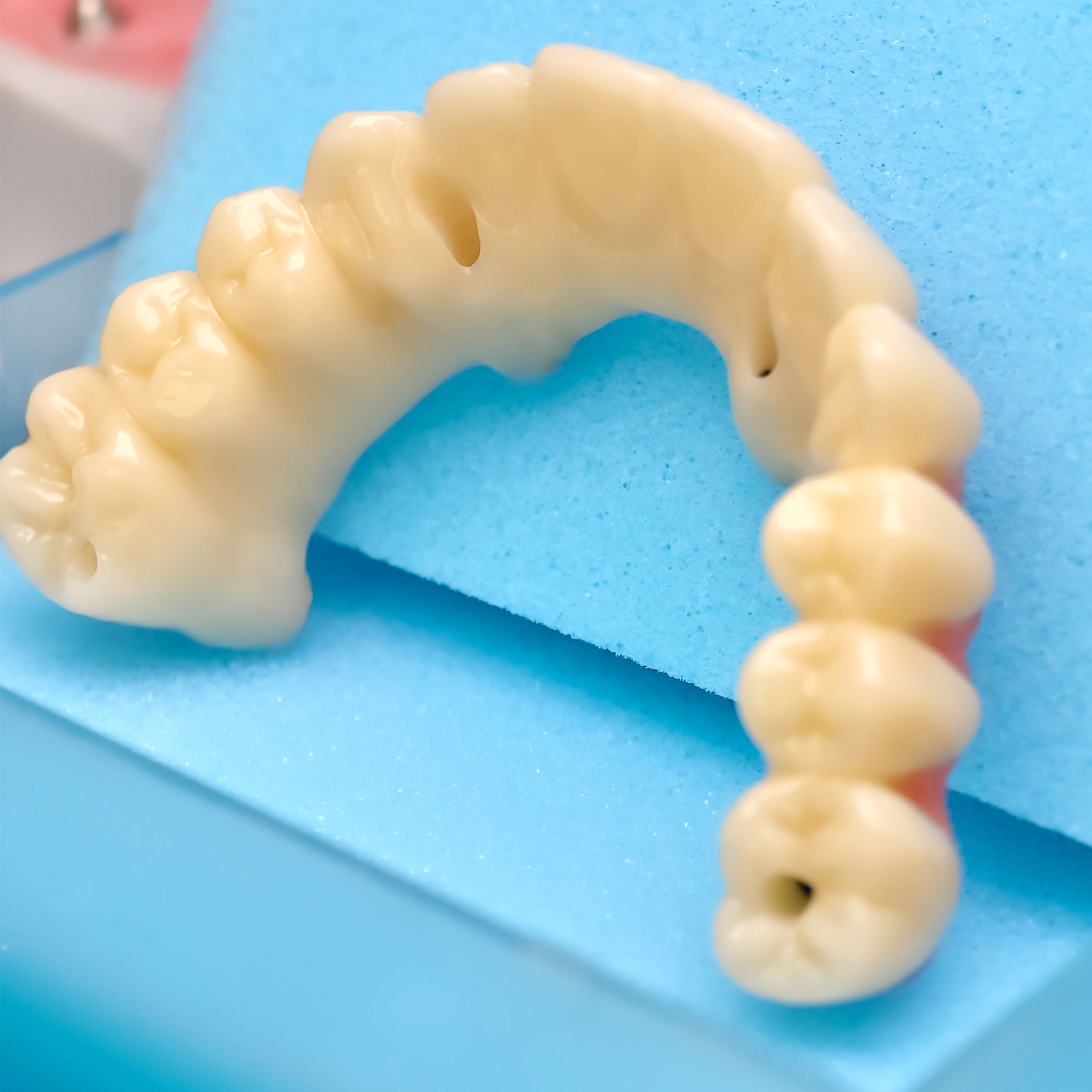 PMMA Bridge With Ti-Base Screw Retained Trying For Full Arch Restoration
