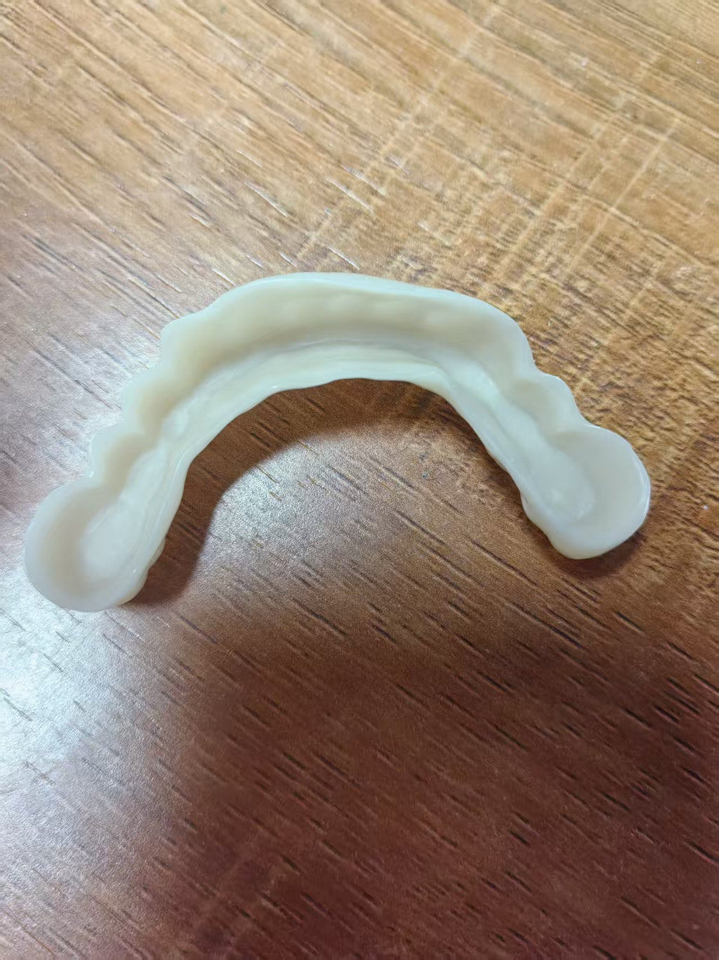 PMMA Bridge With Open Shell Preparing For Full Arch Dental Implants
