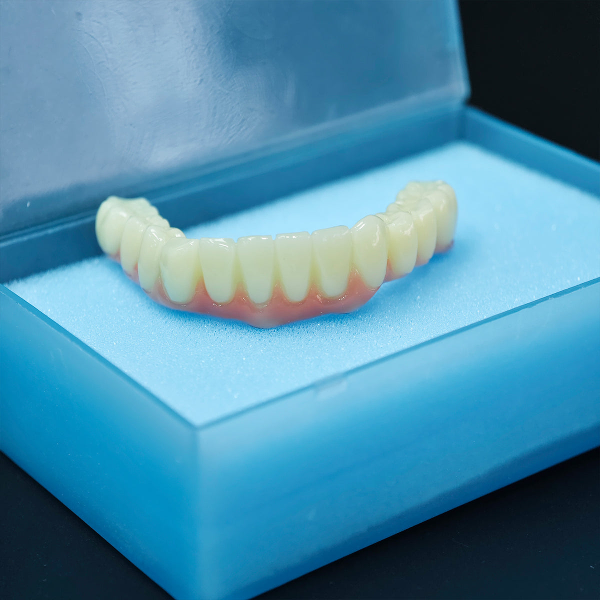 PMMA Bridge With Screw Retained