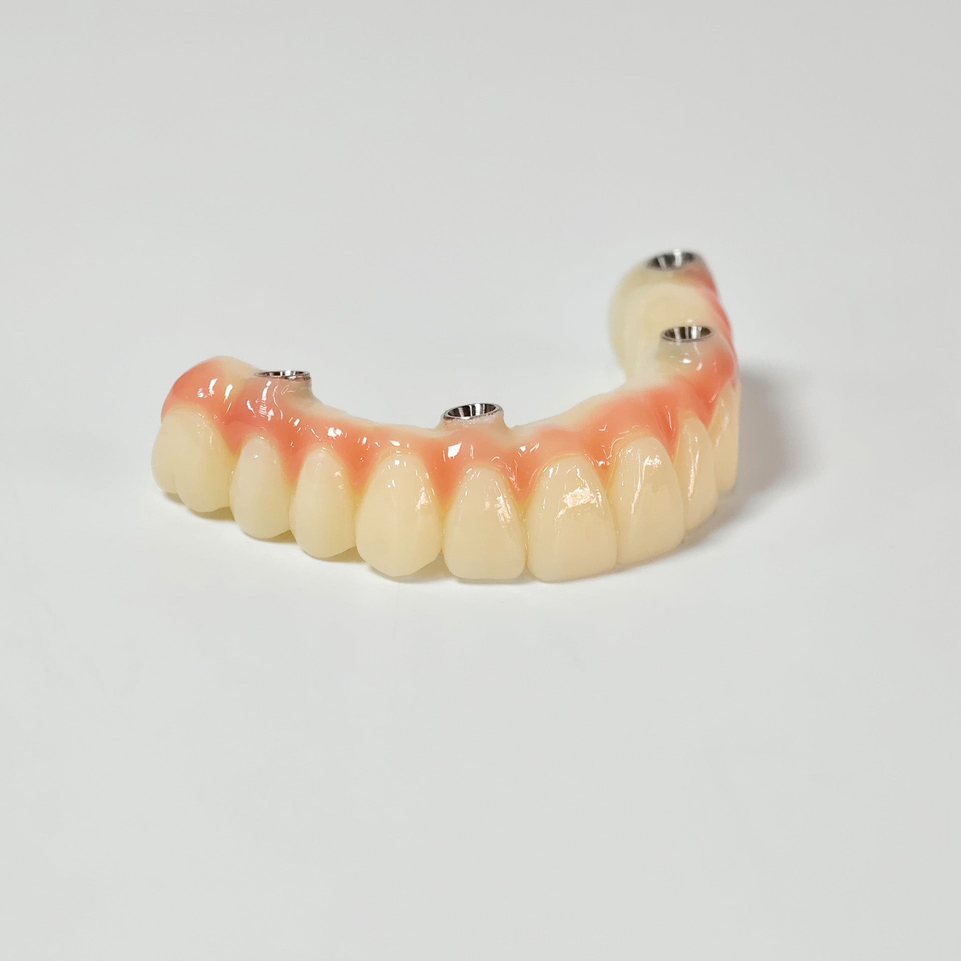 PMMA Bridge With Screw Retained