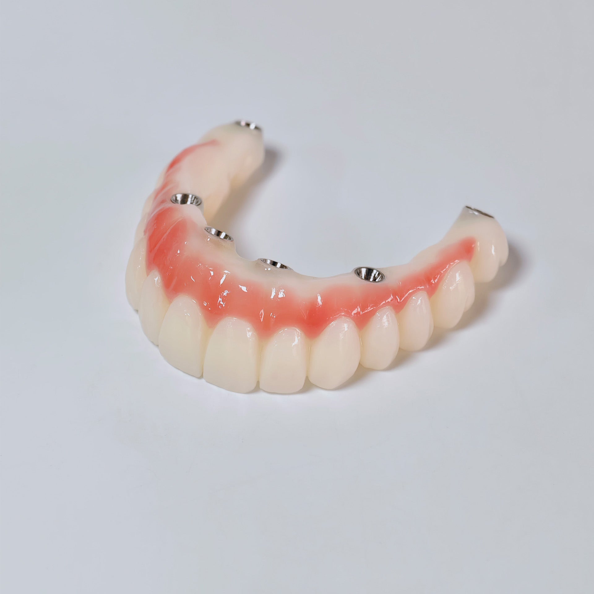 PMMA Bridge With Screw Retained