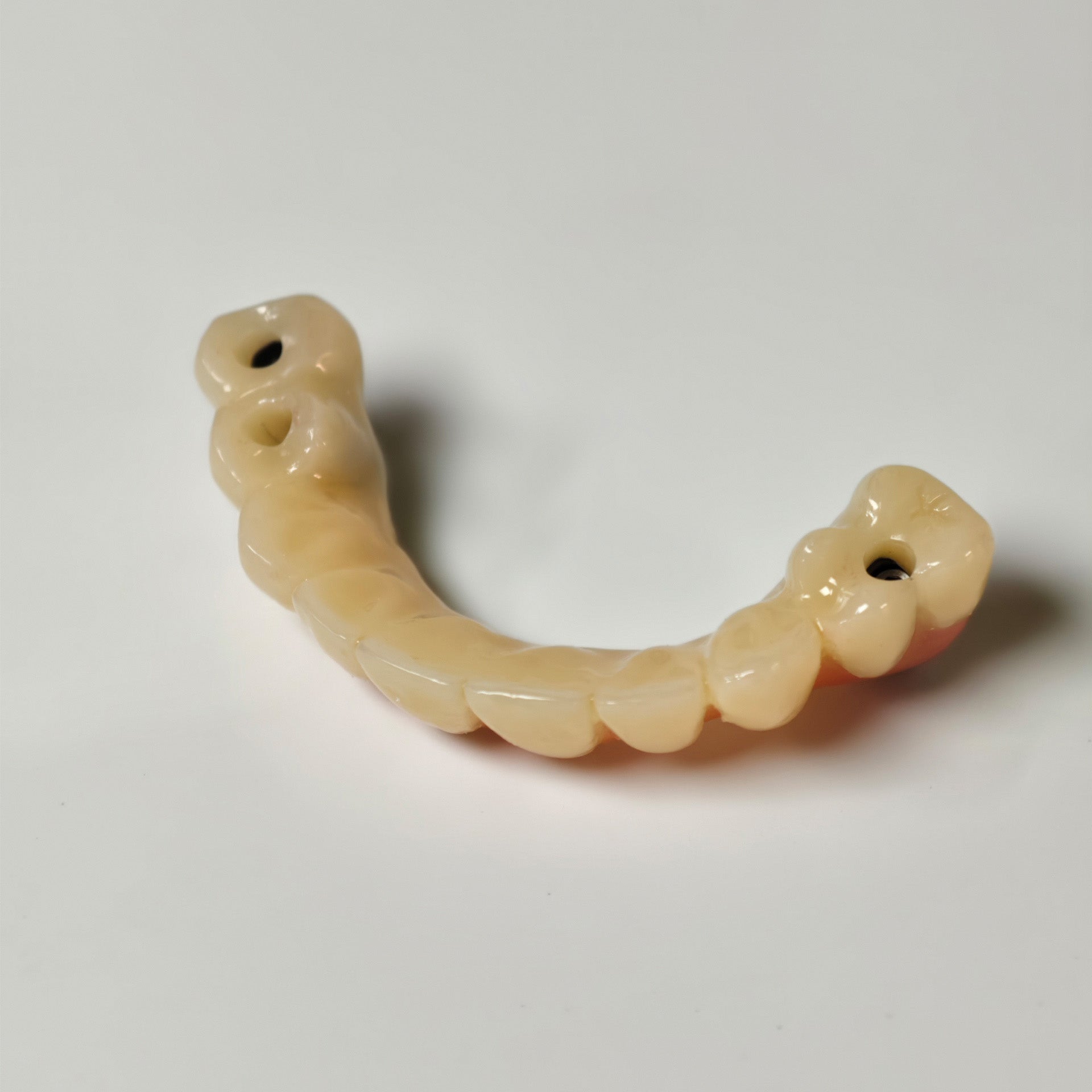 PMMA Bridge With Screw Retained