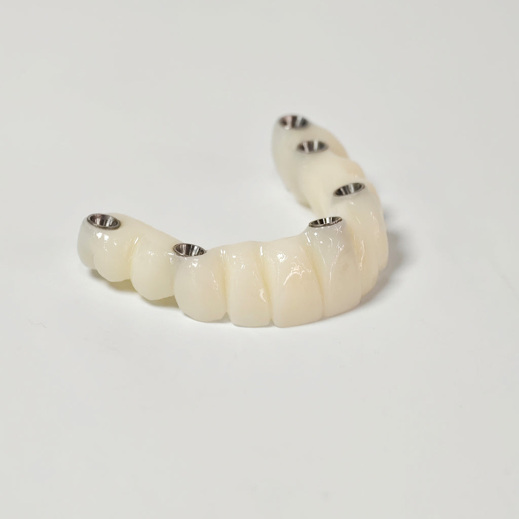 PMMA Bridge With Screw Retained