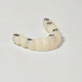 PMMA Bridge With Screw Retained