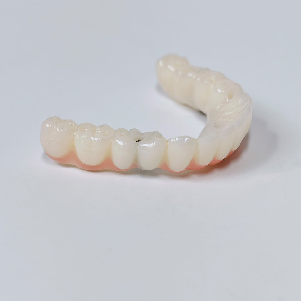 PMMA Bridge With Screw Retained