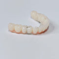 PMMA Bridge With Screw Retained