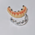 PMMA Bridge With Screw Retained