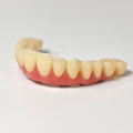 PMMA Bridge With Screw Retained