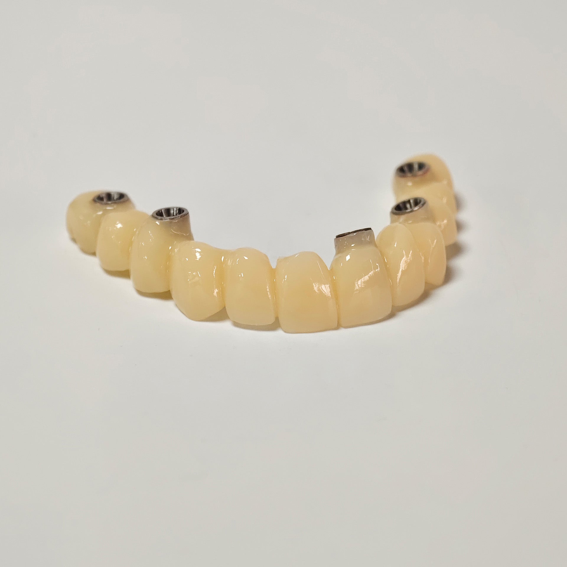 PMMA Bridge With Screw Retained