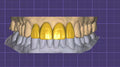 Regular Crown Design