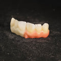 Ti-Bar Pure Titanium Metal Frame With Zirconia Bridge