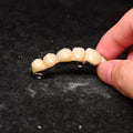 Ti-Bar Pure Titanium Metal Frame With Zirconia Bridge Implant