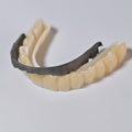 Ti-Bar Titanium Nitride Metal Frame With Zirconia Bridge And Cement Retained