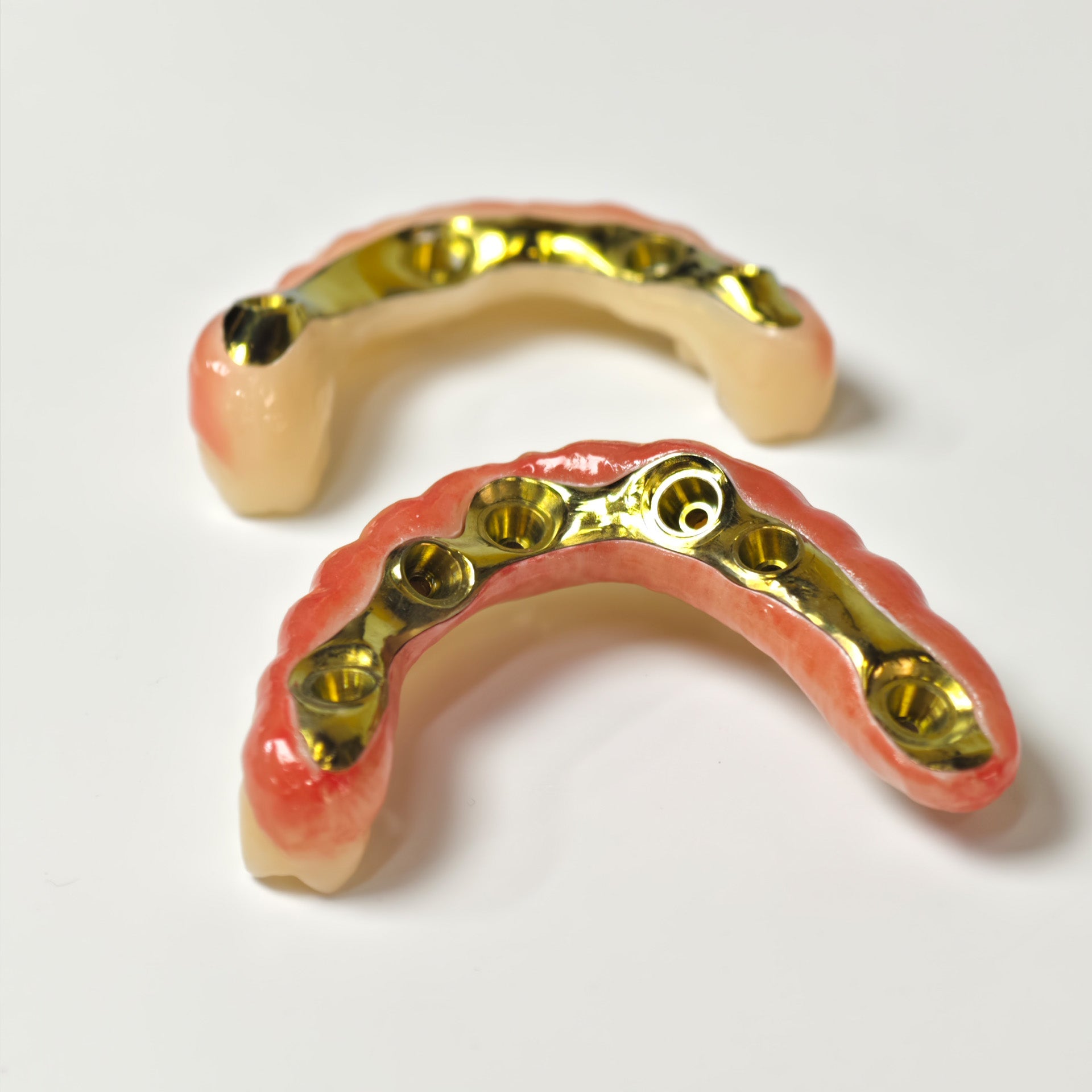 Ti-Bar Titanium Nitride Metal Frame With Zirconia Bridge For Full Arch Restoration